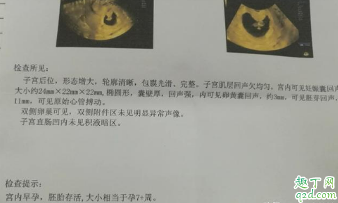 懷孕七周沒有胎心什么原因 懷孕7周肚子有點(diǎn)隱痛怎么回事2