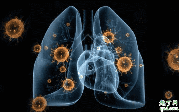 新型冠狀病毒能治愈嗎 新型冠狀病毒肺炎多久能治愈1