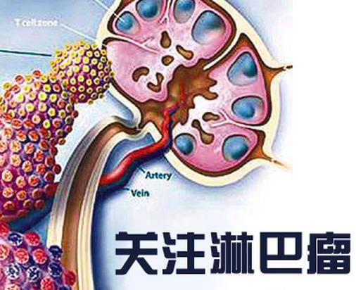 世界十大痛苦癌癥排行，胃癌發(fā)病率高，肺癌死亡率最快