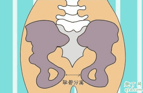 孕期為什么下邊的骨頭疼 孕晚期下腹部疼痛是入盆了嗎5