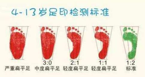 扁平足能跑步嗎？扁平足跑步有什么危害？